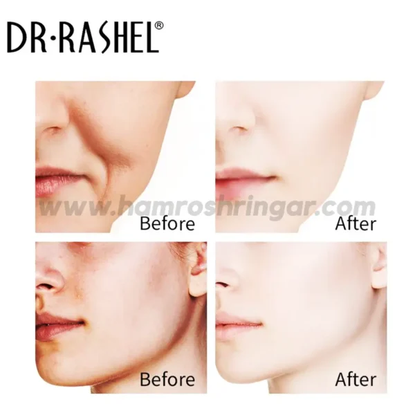 Dr. Rashel Complete Facial Serum Set | Vitamin C Serum, Hyaluronic Acid Serum, Retinol Serum - Before and After