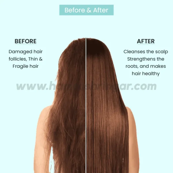 ALZIBA CARES Hair Fall Control Shampoo (Keratin Therapy) - Before and After