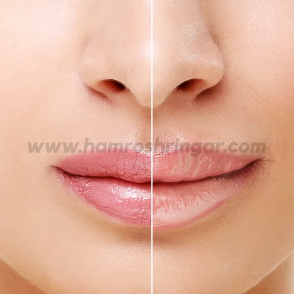 Renee Tease Lip Plumper - Before and After