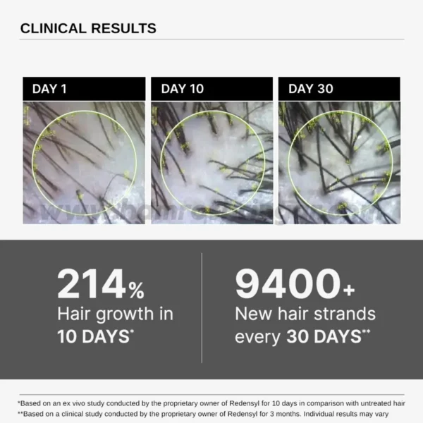Bare Anatomy Advanced Hair Growth Serum - Clinical Results