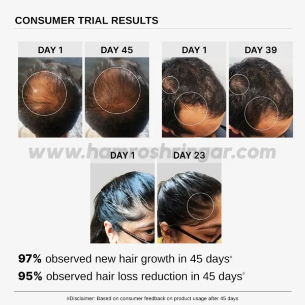 Bare Anatomy Advanced Hair Growth Serum - Customer Trail Results