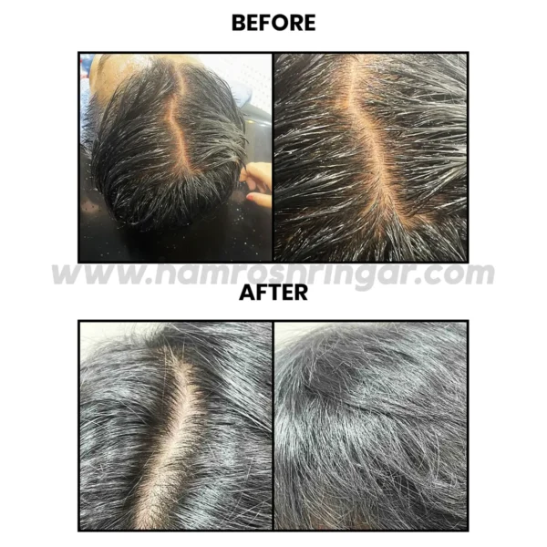 SY Graphene shampoo – Before and After